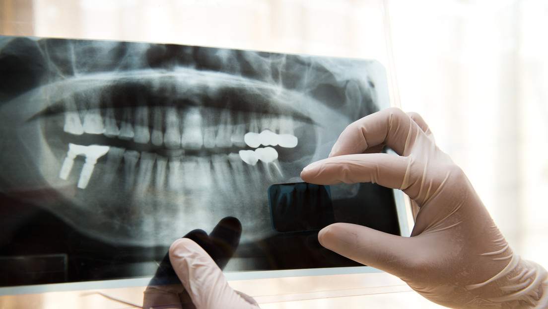 Revelan una inquietante relación entre tu sonrisa y el riesgo de muerte prematura