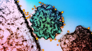 ¿Cuál es el peligro y los síntomas del virus Nipah?