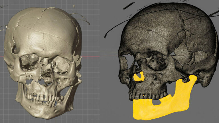 Revelan el rostro de un 'vampiro' mutilado durante un macabro ritual hace más de 400 años