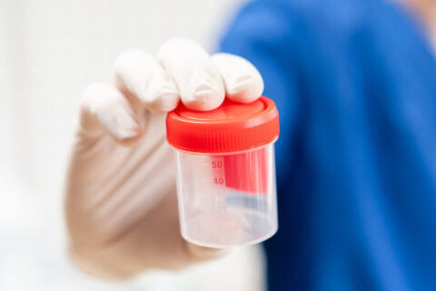 Detectan el primer caso en el mundo de una rara enfermedad transmitida por donación de esperma