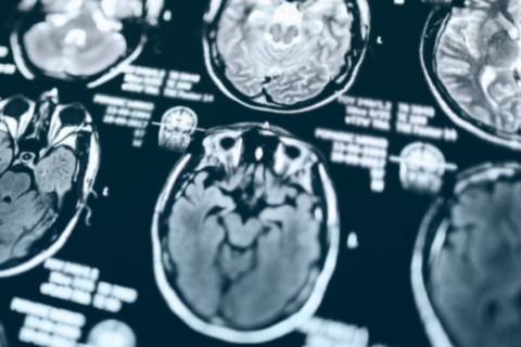 Las tres etapas de la muerte por las que pasa una persona