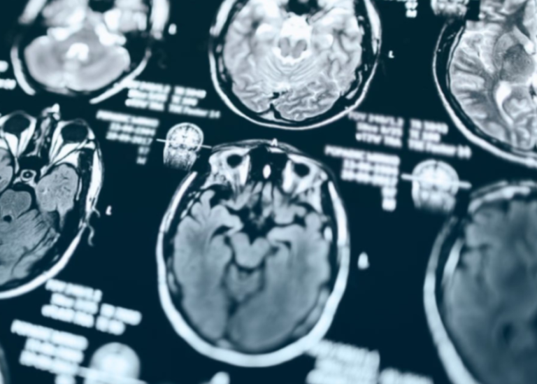 Las tres etapas de la muerte por las que pasa una persona