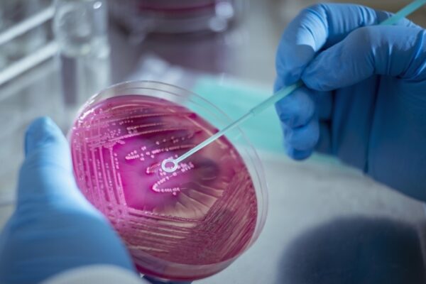 La resistencia a los antibióticos vuelve más vulnerables a los niños de todo el mundo