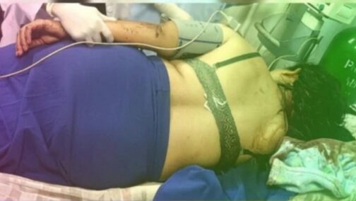 Atacan a machetazos a una mujer en El Rama tras negarse a retomar una relación sentimental
