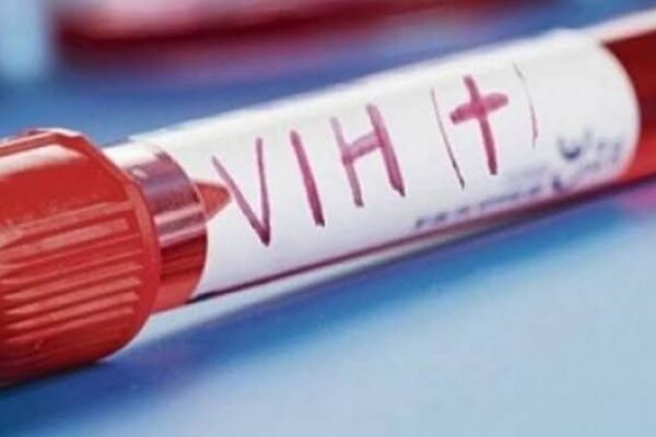 Prueban un nuevo medicamento contra el VIH en humanos y los resultados sorprenden