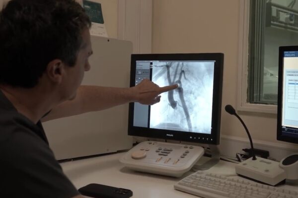 Cirugía inédita: por primera vez, colocaron un stent bioabsorbible en un bebé prematuro