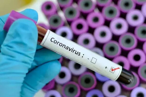 El Covid en Nicaragua en ascenso, reportan 70 contagios en la primera semana de agosto
