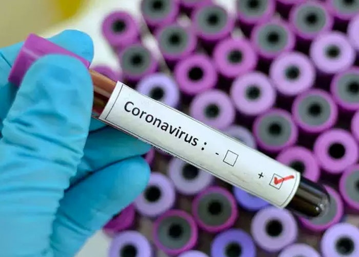 El Covid en Nicaragua en ascenso, reportan 70 contagios en la primera semana de agosto