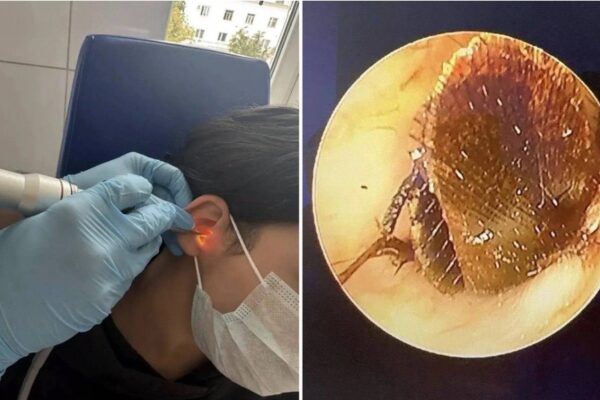 Mujer va al médico por un fuerte dolor y descubren algo aterrador en su oído