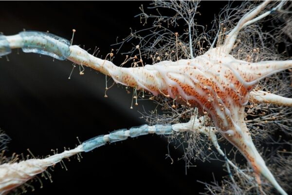 La inesperada clave detrás de la propagación de una enfermedad incurable en el cerebro