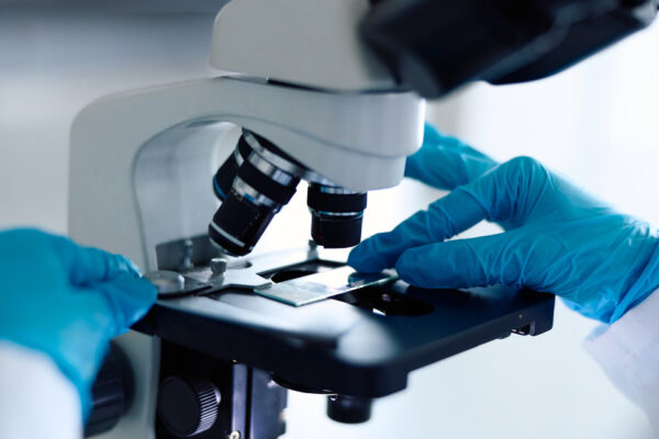 Revolucionario: descubren cómo predecir el cáncer de próstata hasta 15 años antes de que aparezca