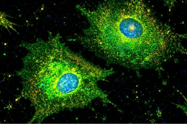 Revelan que las células cancerosas se convierten en ‘zombis’ para sobrevivir a la quimioterapia